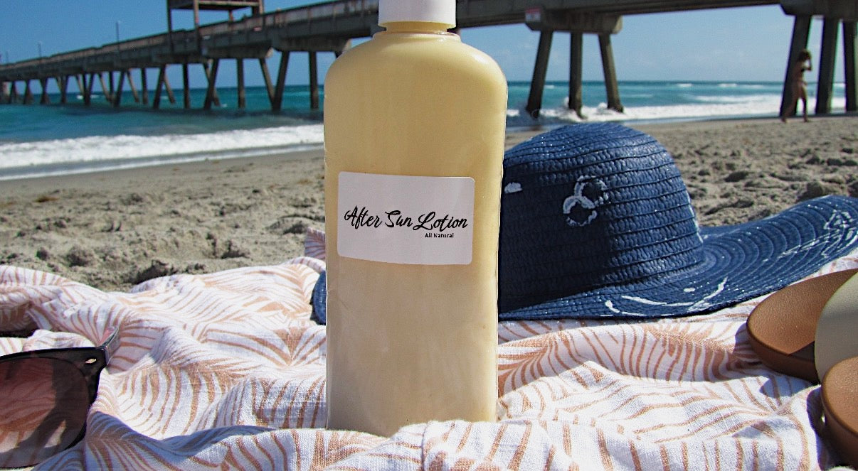 After Sun Lotion